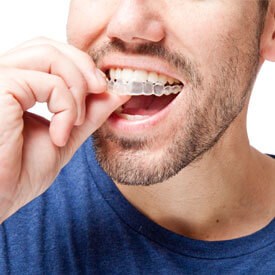 Mouthguards 